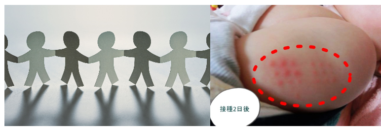 乳児のbcgにおけるコッホ現象について Font Size 6 斎賀医院壁新聞 Font