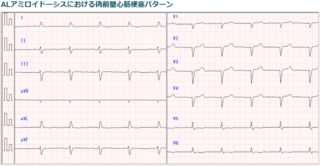 70127-2.PNG